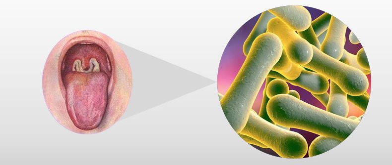 Characteristics, causes, symptoms, transmission routes, and prevention of diphtheria